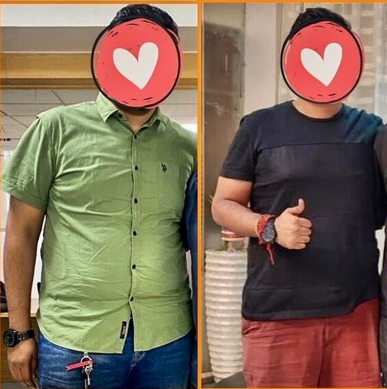 Before and after weight loss transformation